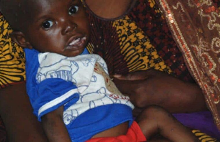 Mali’s malnutrition crisis: public health emergency and solutions