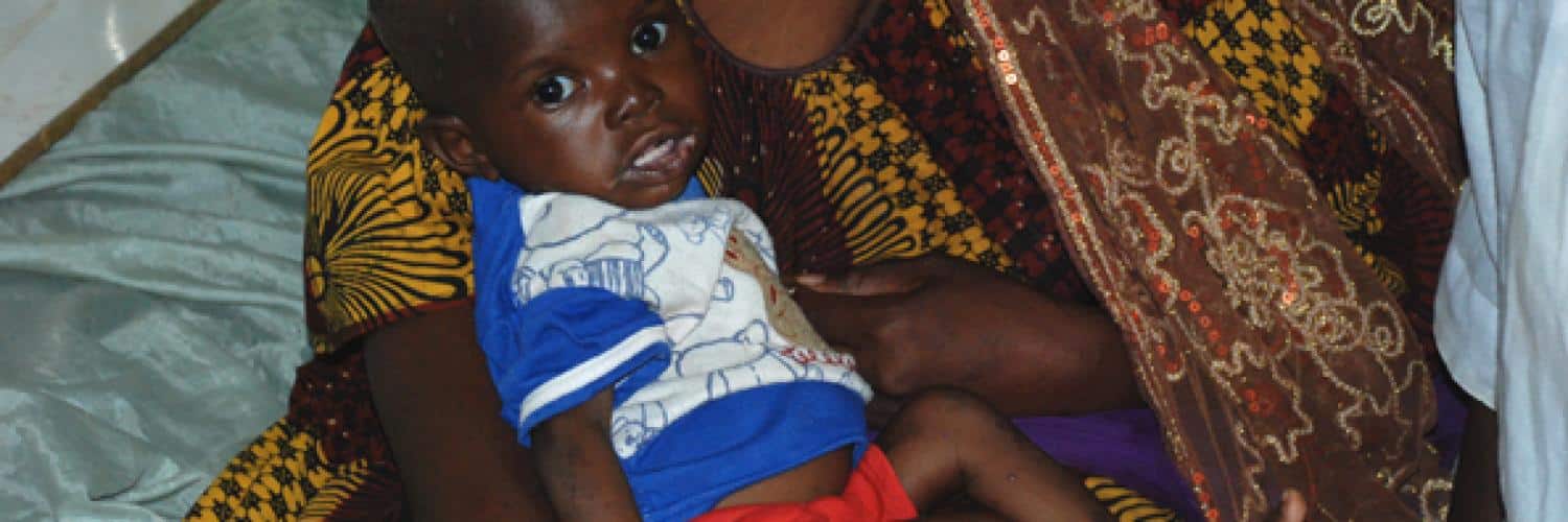 Mali’s malnutrition crisis: public health emergency and solutions