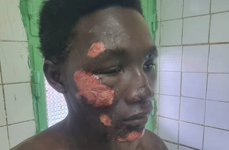 Tchad : un père dénonce un échec sécuritaire après l’agression près du camp 27