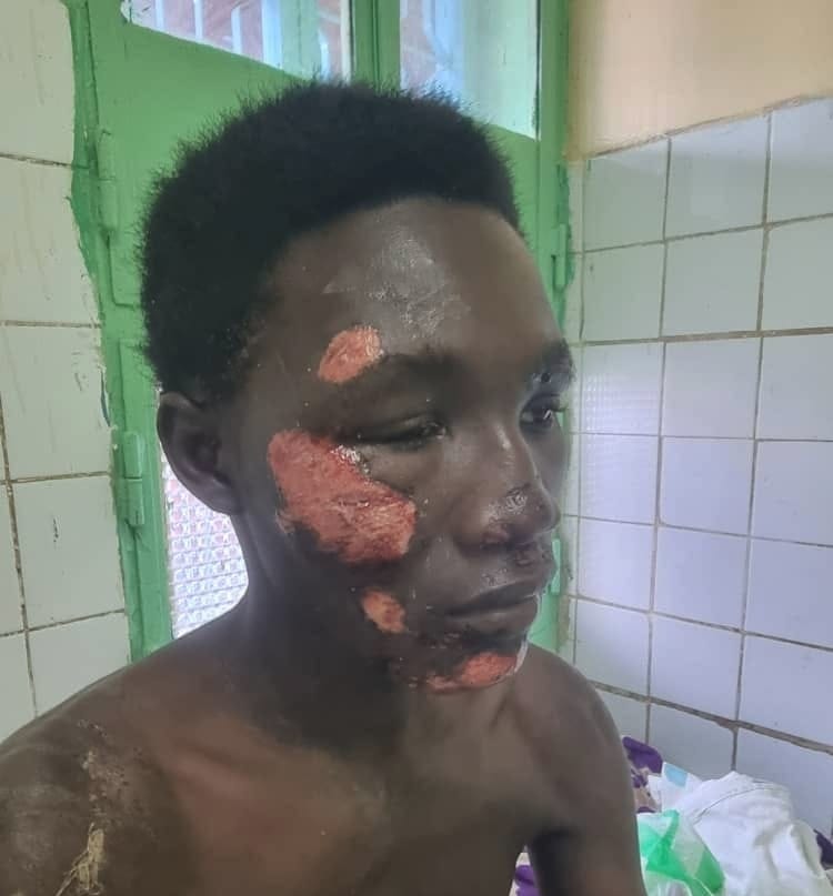 Tchad : un père dénonce un échec sécuritaire après l’agression près du camp 27